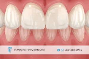 علاج التهاب اللثة الأسباب والأعراض