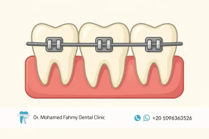 مراكز تقويم الأسنان