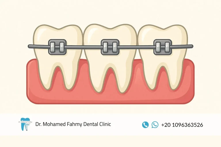 مراكز تقويم الأسنان