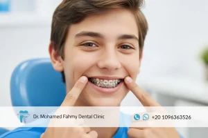 تقويم الأسنان قبل وبعد