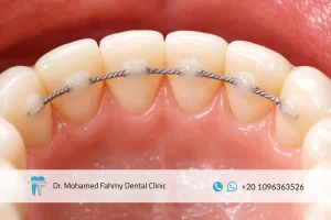 مثبت التقويم