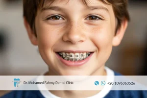 مدة تقويم الأسنان