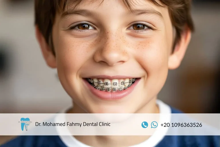 مدة تقويم الأسنان