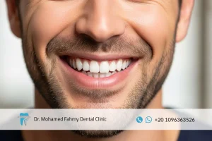 هوليود سمايل