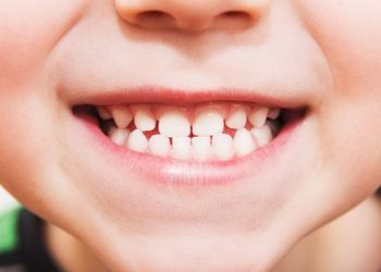 اسنان-الاطفال3